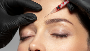 Botox in Lafayette